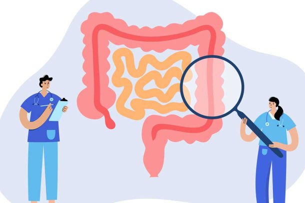 illustratie van doktoren die met een vergrootglas de dikke darm onderzoeken